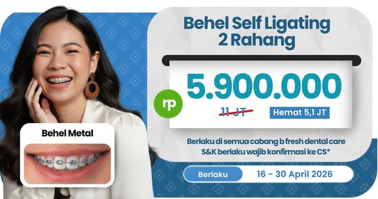 Behel Self Ligating (2 rahang)